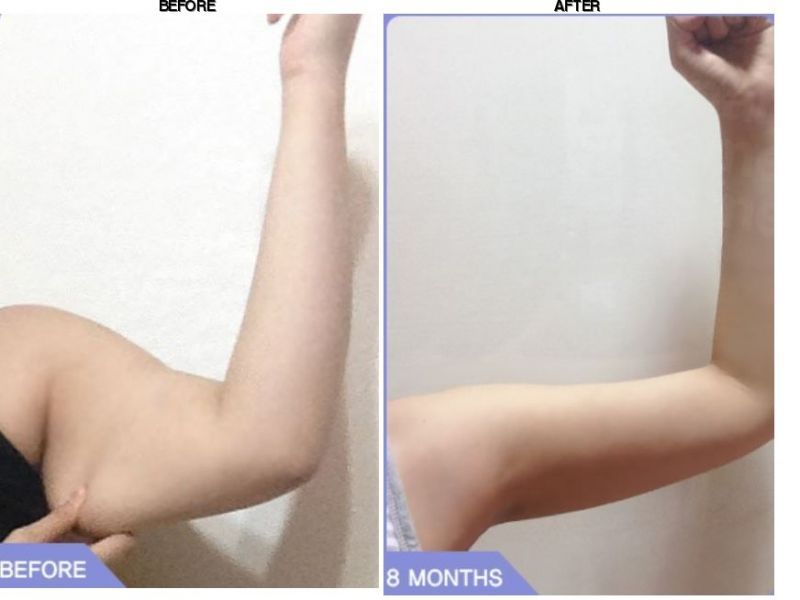 Grand Plastic Surgery before-after