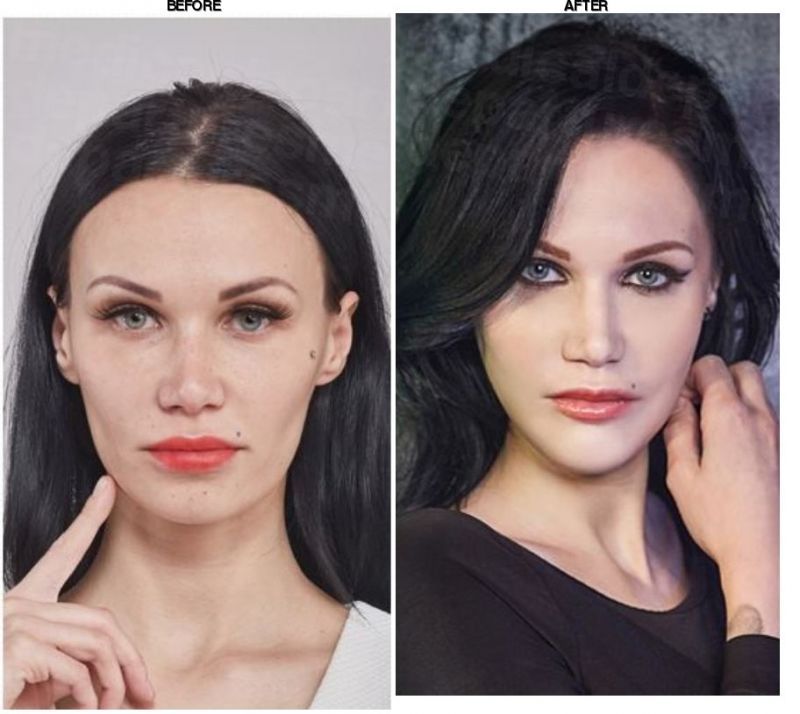 Grand Plastic Surgery before-after