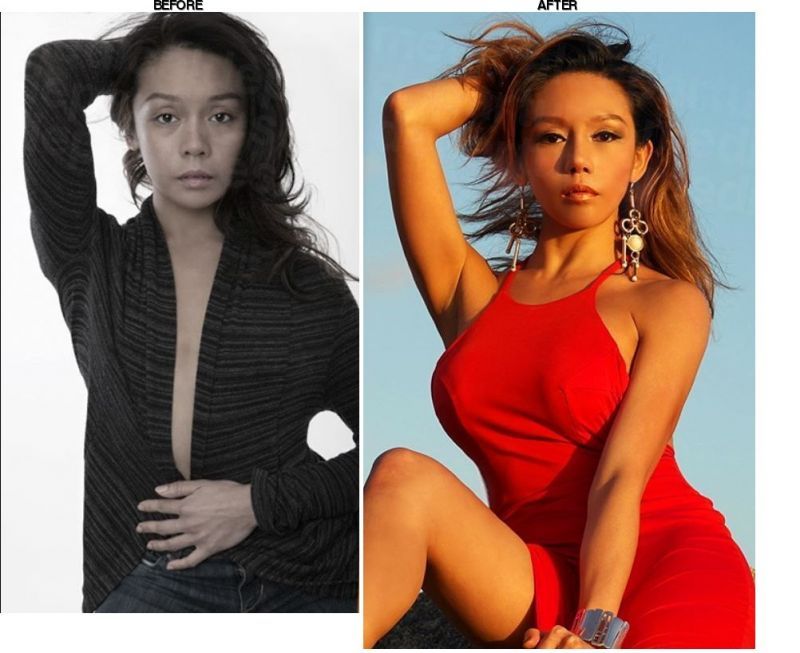 Grand Plastic Surgery before-after