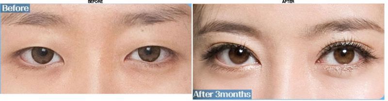 Grand Plastic Surgery before-after