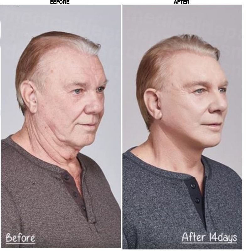 Grand Plastic Surgery before-after
