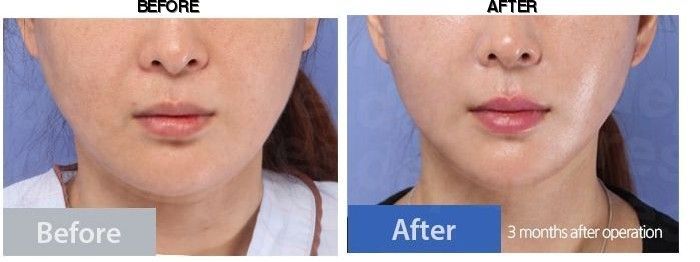 Dream Medical Group before-after