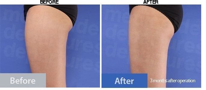 Dream Medical Group before-after