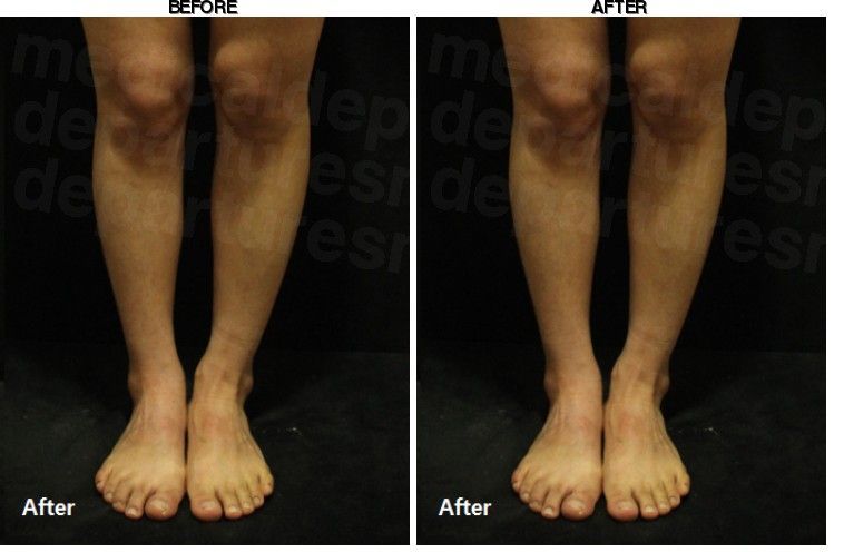 JSME Clinic before-after