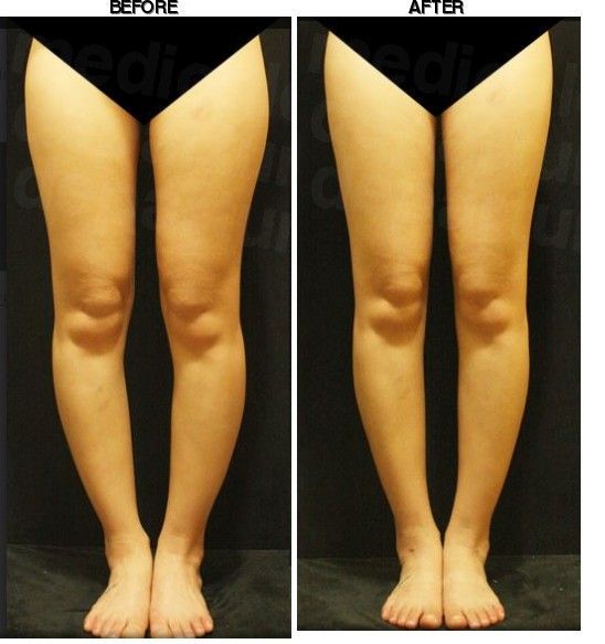 JSME Clinic before-after