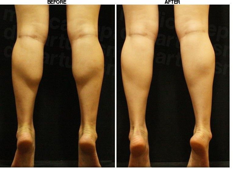 JSME Clinic before-after