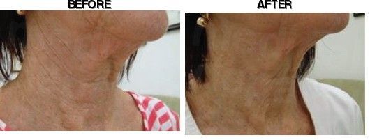 Dr. Kim's Skin Laser & Esthetic before-after