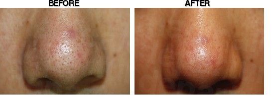 Dr. Kim's Skin Laser & Esthetic before-after