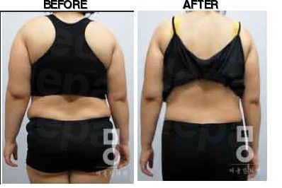 Miall Korean Medicine Clinic (Ansan) before-after