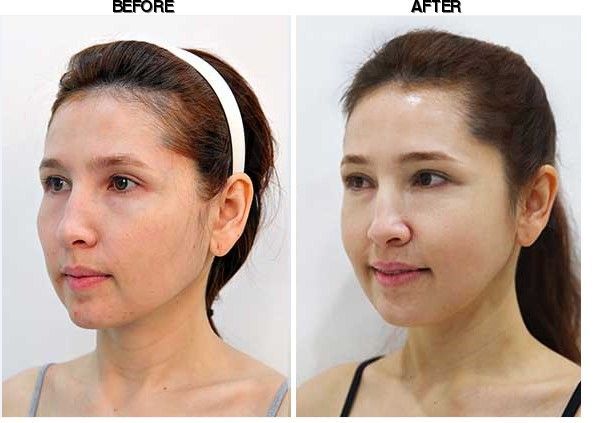 Youth Clinic before-after