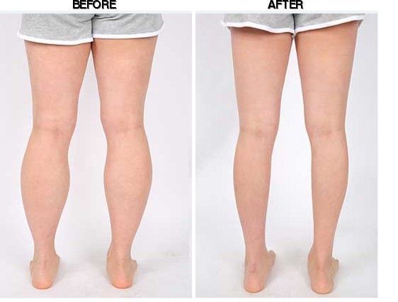 Youth Clinic before-after