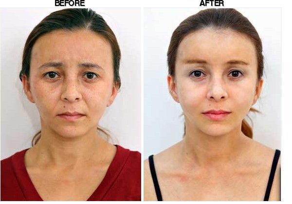 Youth Clinic before-after