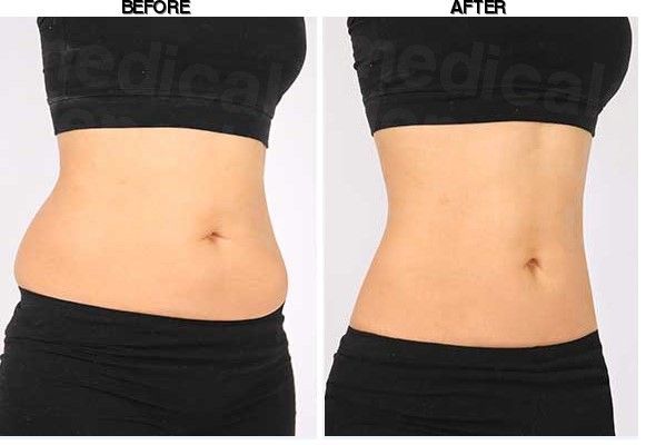 Youth Clinic before-after