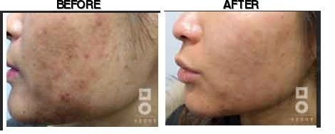 Miall Korean Medicine Clinic (Gimpo) before-after