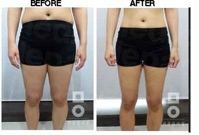 Miall Korean Medicine Clinic (Gimpo) before-after