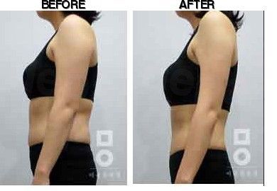 Miall Korean Medicine Clinic (Dongtan) before-after