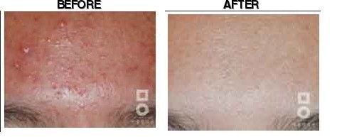 Miall Korean Medicine Clinic (Dongtan) before-after
