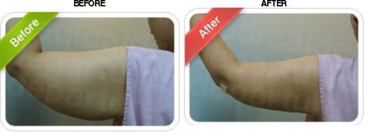 Oracle Clinic (Sinchon) before-after