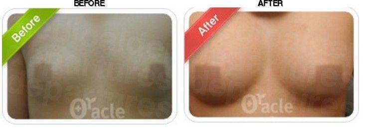 Oracle Clinic (Gangbyeon) before-after