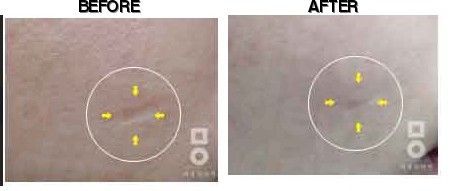 Miall Korean Medicine Clinic (Mokdong) before-after