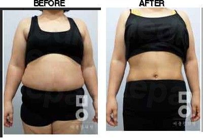 Miall Korean Medicine Clinic (Mokdong) before-after