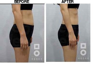 Miall Korean Medicine Clinic (Uijeongbu) before-after