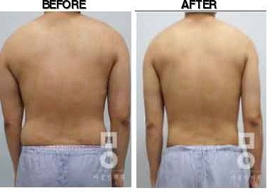 Miall Korean Medicine Clinic (Uijeongbu) before-after
