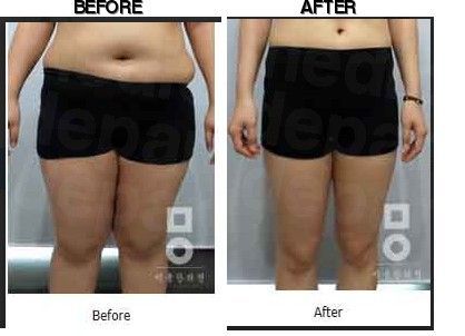 Miall Korean Medicine Clinic (Paju) before-after