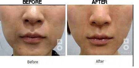 Miall Korean Medicine Clinic (Paju) before-after