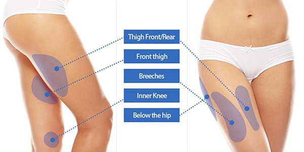 thigh liposuction features