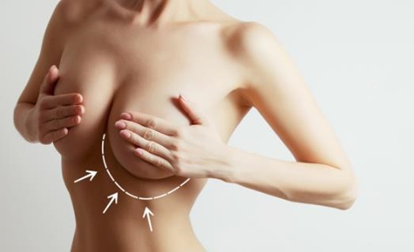 Breast augmentation