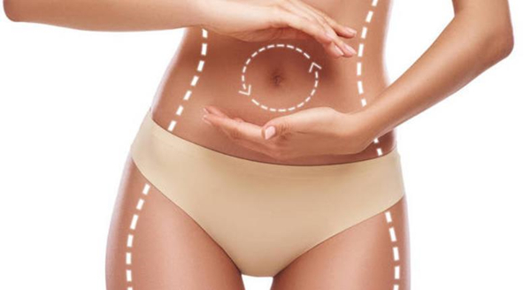 Tummy Tuck