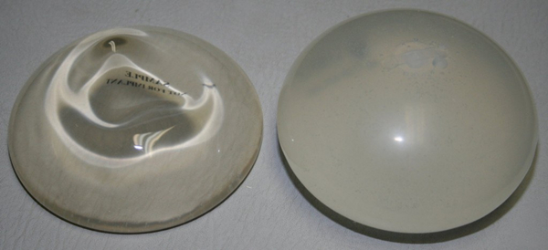 Difference between saline and silicone implants