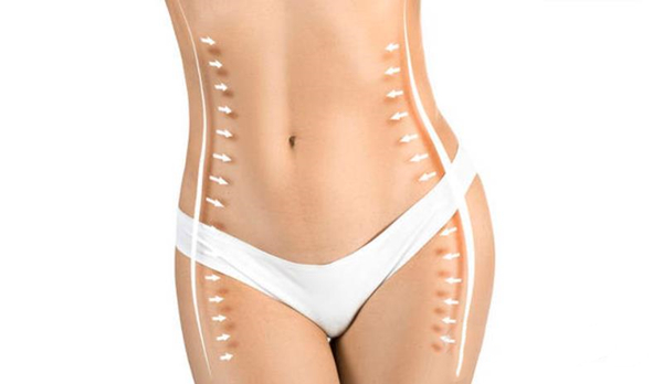 Tummy Tuck