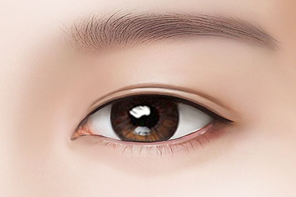 eye plastic surgery 