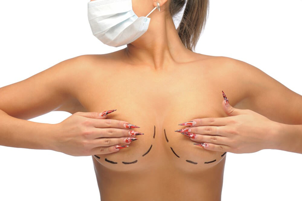 What is Breast Lift in South Korea?